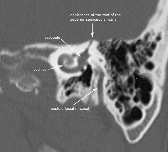 ear
